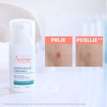 Eau Thermale Avène  Cleanance Comedomed koncentrat protiv nepravilnosti 30ml - Image 3