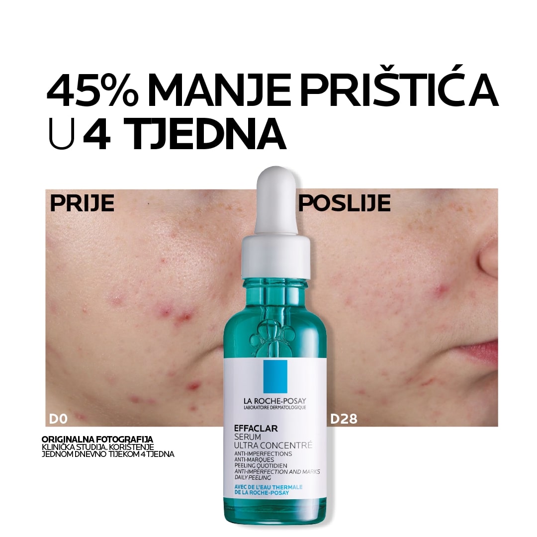 La Roche Posay EFFACLAR SERUM Dnevni piling protiv nepravilnosti za kožu sklonu aknama, 30 ml - Image 4