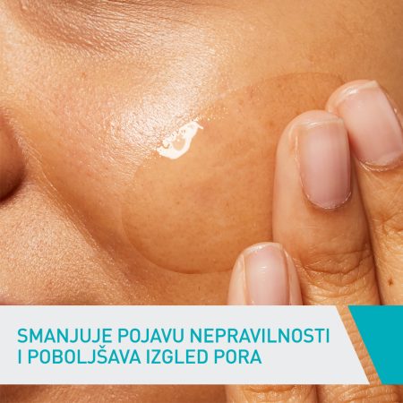 Slika 5