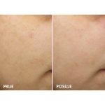 Vichy Liftactiv B3 noćna krema sa retinolom 50ml - Image 6