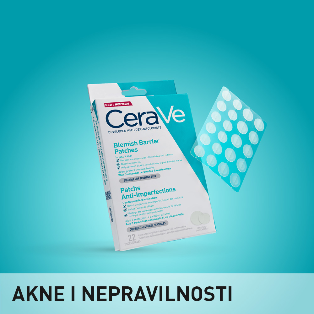 Akne i nepravilnosti
