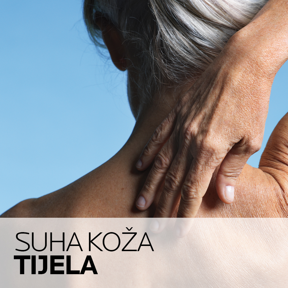 Suha koža tijela